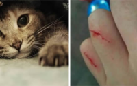 被猫抓伤，要打狂犬病疫苗吗？
